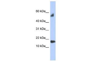 FLJ35767 antibody used at 1 ug/ml to detect target protein. (FLJ35767 (Middle Region) anticorps)