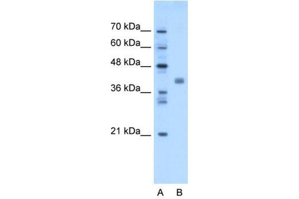 TMEM59L anticorps  (N-Term)