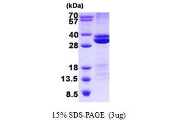 RASSF3 Protein (His tag)