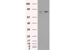 HEK293T cells were transfected with the pCMV6-ENTRY control (Left lane) or pCMV6-ENTRY NTRK3 (Right lane) cDNA for 48 hrs and lysed. (NTRK3 anticorps)