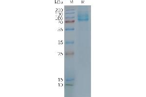 Human R-Nanodisc, Flag Tag on SDS-PAGE (GLP2R Protéine)