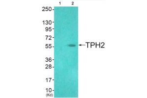 Western blot analysis of extracts from HuvEc cells (Lane 2), using TPH2 (epitope around residue 19) Antibody. (Tryptophan Hydroxylase 2 anticorps  (Ser19))