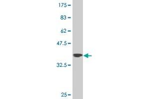 Western Blot detection against Immunogen (37. (ZNF281 anticorps  (AA 787-893))