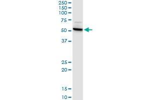 Western Blotting (WB) image for anti-Cystinosis, Nephropathic (CTNS) (AA 1-100) antibody (ABIN560527)