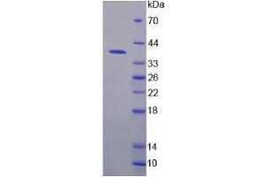 SDS-PAGE of Protein Standard from the Kit  (Highly purified E. (NFkB Kit ELISA)