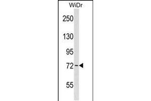 Western blot analysis in WiDr cell line lysates (35ug/lane). (WEE1 anticorps  (AA 202-230))