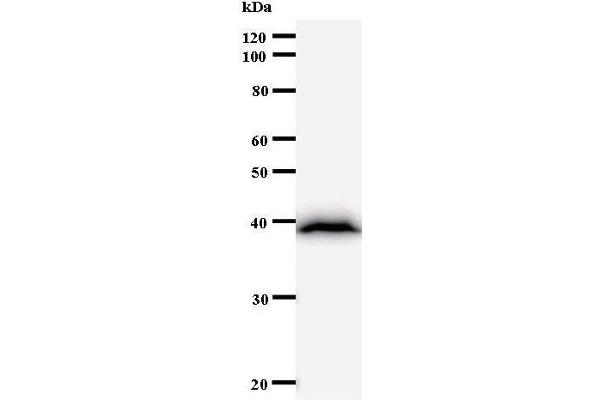 BAZ1B anticorps