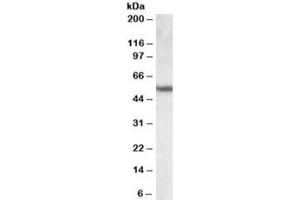 Western blot testing of human lung lysate with Cytokeratin 13 antibody at 0. (Cytokeratin 13 anticorps)