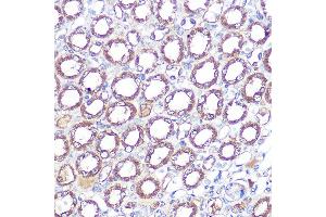 Immunohistochemistry of paraffin-embedded mouse kidney using ERK5 Rabbit mAb (ABIN1680723, ABIN3018327, ABIN3018328 and ABIN7101595) at dilution of 1:100 (40x lens). (MAPK7 anticorps)