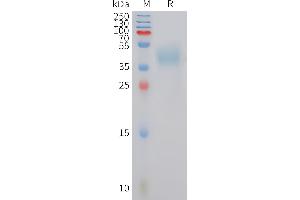 Human MC4R Protein, hFc Tag on SDS-PAGE under reducing condition. (MC4R Protein (AA 1-43) (Fc Tag))