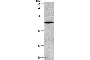 Western blot analysis of Hela cell, using APG4B Polyclonal Antibody at dilution of 1:500 (ATG4B anticorps)