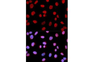 Immunofluorescence (IF) image for anti-Minichromosome Maintenance Complex Component 6 (MCM6) (AA 562-821) antibody (ABIN6219105) (MCM6 anticorps  (AA 562-821))