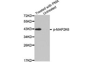 Western blot analysis of extracts from HL60 cells, using phospho-MAP2K6-S207 antibody (MAP2K6 anticorps  (pSer207))