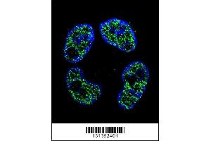 Confocal immunofluorescent analysis of FRAT2 Antibody with ZR-75-1 cell followed by Alexa Fluor 488-conjugated goat anti-rabbit lgG (green). (FRAT2 anticorps  (C-Term))