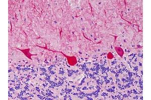 Human Cerebellum: Formalin-Fixed, Paraffin-Embedded (FFPE) (CARD11 anticorps)