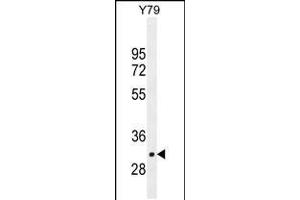 Western blot analysis in Y79 cell line lysates (35ug/lane). (LRRC46 anticorps  (N-Term))