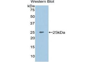 Western Blotting (WB) image for anti-Matrix Extracellular phosphoglycoprotein (MEPE) (AA 28-224) antibody (ABIN1859803) (MEPE anticorps  (AA 28-224))