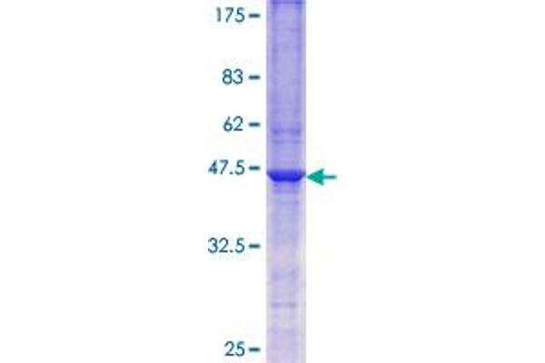 SGK1 Protein (AA 113-252) (GST tag)