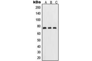 Western blot analysis of NF-kappaB p65 (pS311) expression in HeLa TNFa-treated (A), mouse kidney (B), PC12 UV-treated (C) whole cell lysates. (NF-kB p65 anticorps  (pSer311))