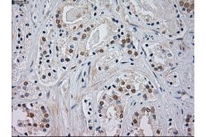 Immunohistochemistry (IHC) image for anti-Mitogen-Activated Protein Kinase 8 (MAPK8) (AA 1-384) antibody (ABIN1490768) (JNK anticorps  (AA 1-384))