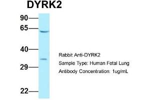 Host: Rabbit  Target Name: DYRK2  Sample Tissue: Human Fetal Lung  Antibody Dilution: 1. (DYRK2 anticorps  (C-Term))
