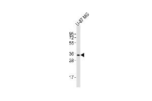 Western Blotting (WB) image for anti-MHC Class I Polypeptide-Related Sequence A (MICA) (AA 68-97) antibody (ABIN652566)