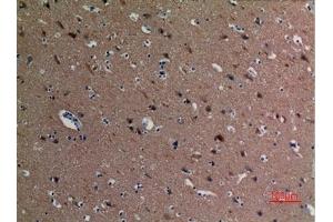 Immunohistochemical analysis of paraffin-embedded human-brain, antibody was diluted at 1:100. (alpha Tubulin anticorps  (acLys40))