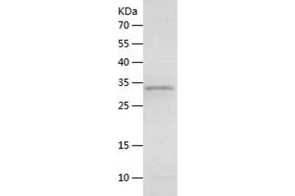 CGRP Protein (AA 26-128) (His-IF2DI Tag)