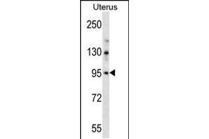 Western blot analysis in human normal Uterus tissue lysates (35ug/lane). (LRRC37B anticorps  (C-Term))