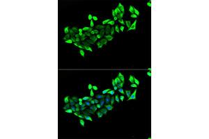 Immunofluorescence analysis of HeLa cells using FLOT1 antibody (ABIN5973661). (Flotillin 1 anticorps)