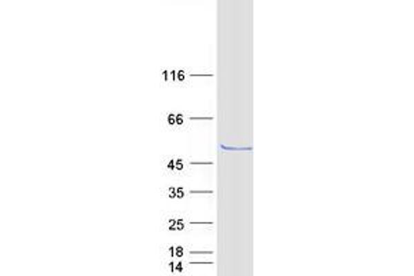 OXSM Protein (Transcript Variant 1) (Myc-DYKDDDDK Tag)