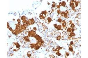 IHC testing of FFPE human pituitary gland with ACTH antibody (clone CLIP/1407). (CLIP anticorps  (AA 25-39))