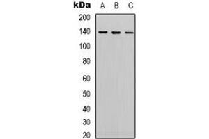 Western blot analysis of HER2 expression in Hela (A), 293 (B), Jurkat (C) whole cell lysates. (ErbB2/Her2 anticorps)