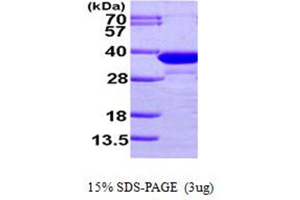 ECH1 Protein (AA 34-328) (His tag)