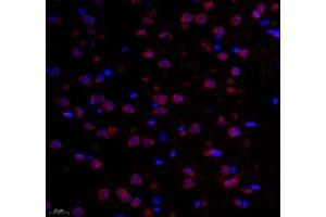 Immunofluorescence of paraffin embedded rat corpus striatum using GPR137A (ABIN7073996) at dilution of 1: 6500 (400x lens) (GPR137 anticorps)