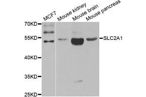 Western blot analysis of extracts of various cell lines, using SLC2A1 antibody. (GLUT1 anticorps)