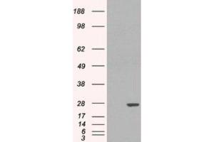 Western Blotting (WB) image for anti-Glutathione S-Transferase pi 1 (GSTP1) (Internal Region) antibody (ABIN2465797) (GSTP1 anticorps  (Internal Region))
