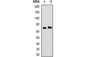 Western blot analysis of MAVS expression in HepG2 (A), MCF7 (B) whole cell lysates. (MAVS anticorps)