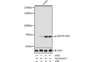 Western blot analysis of extracts of Jurkat cells using Phospho-ZAP70(Y493) Polyclonal Antibody at dilution of 1:5000. (ZAP70 anticorps  (pTyr493))