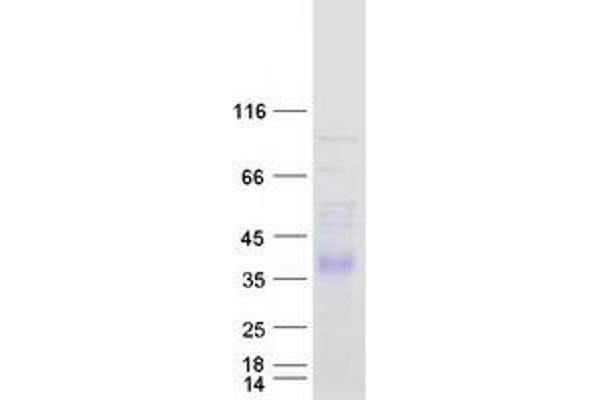 DHRS1 Protein (Transcript Variant 2) (Myc-DYKDDDDK Tag)