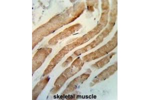 Immunohistochemistry (IHC) image for anti-RAB7A, Member RAS Oncogene Family (RAB7A) antibody (ABIN3003858) (RAB7A anticorps)