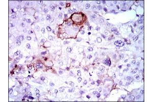 Immunohistochemistry (IHC) image for anti-Lipoprotein (Lp(a)) (AA 1823-2013) antibody (ABIN969533)