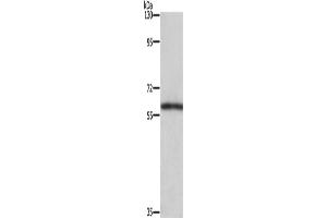 Western Blotting (WB) image for anti-T-Box 5 (TBX5) antibody (ABIN2434989) (T-Box 5 anticorps)