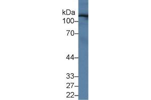 Western blot analysis of Human Serum, using Human UGGT2 Antibody (1 µg/ml) and HRP-conjugated Goat Anti-Rabbit antibody ( (UGCGL2 anticorps  (AA 1221-1408))