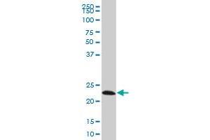 EFHD1 monoclonal antibody (M08), clone 1F5 Western Blot analysis of EFHD1 expression in Hela S3 NE . (EFHD1 anticorps  (AA 168-238))