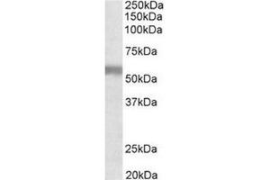 AP31705PU-N (1µg/ml) staining of Human Placenta lysate (35µg protein in RIPA buffer). (NPR3 anticorps  (C-Term))