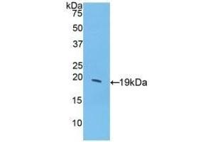 Detection of Recombinant GCSF, Porcine using Polyclonal Antibody to Colony Stimulating Factor 3, Granulocyte (GCSF) (G-CSF anticorps  (AA 34-193))