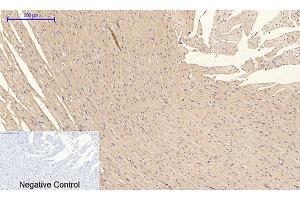 Immunohistochemical analysis of paraffin-embedded rat heart tissue. (PI3K p85/p55 anticorps  (pTyr199, pTyr467))