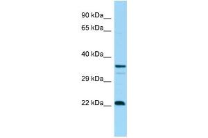 WB Suggested Anti-CD83 Antibody Titration: 1. (CD83 anticorps  (C-Term))