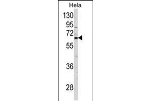 Western blot analysis of CTPS2 Antibody in Hela cell line lysates (35ug/lane) (CTPS2 anticorps  (N-Term))